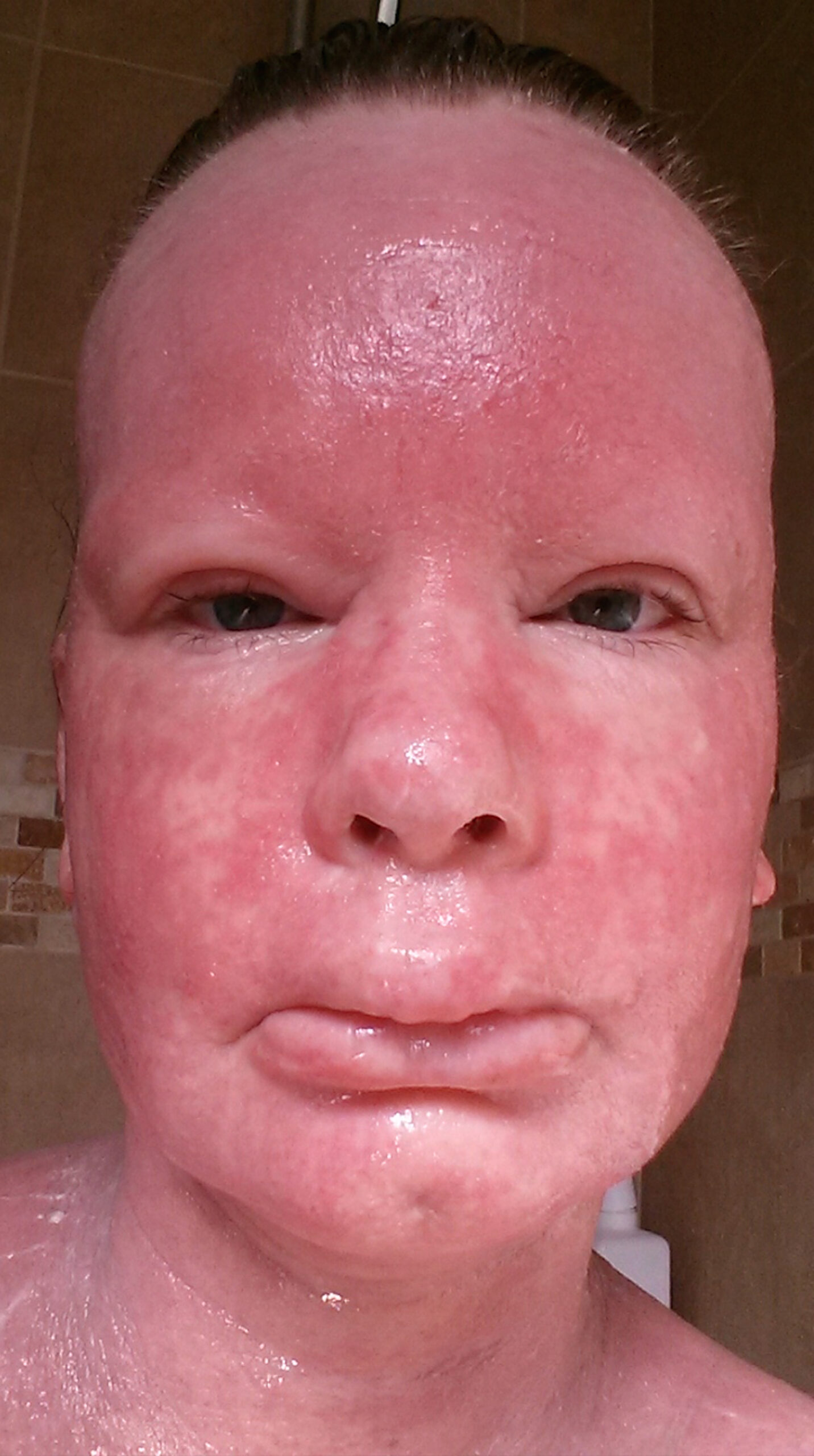 STEROID CREAM MUM MONSTER