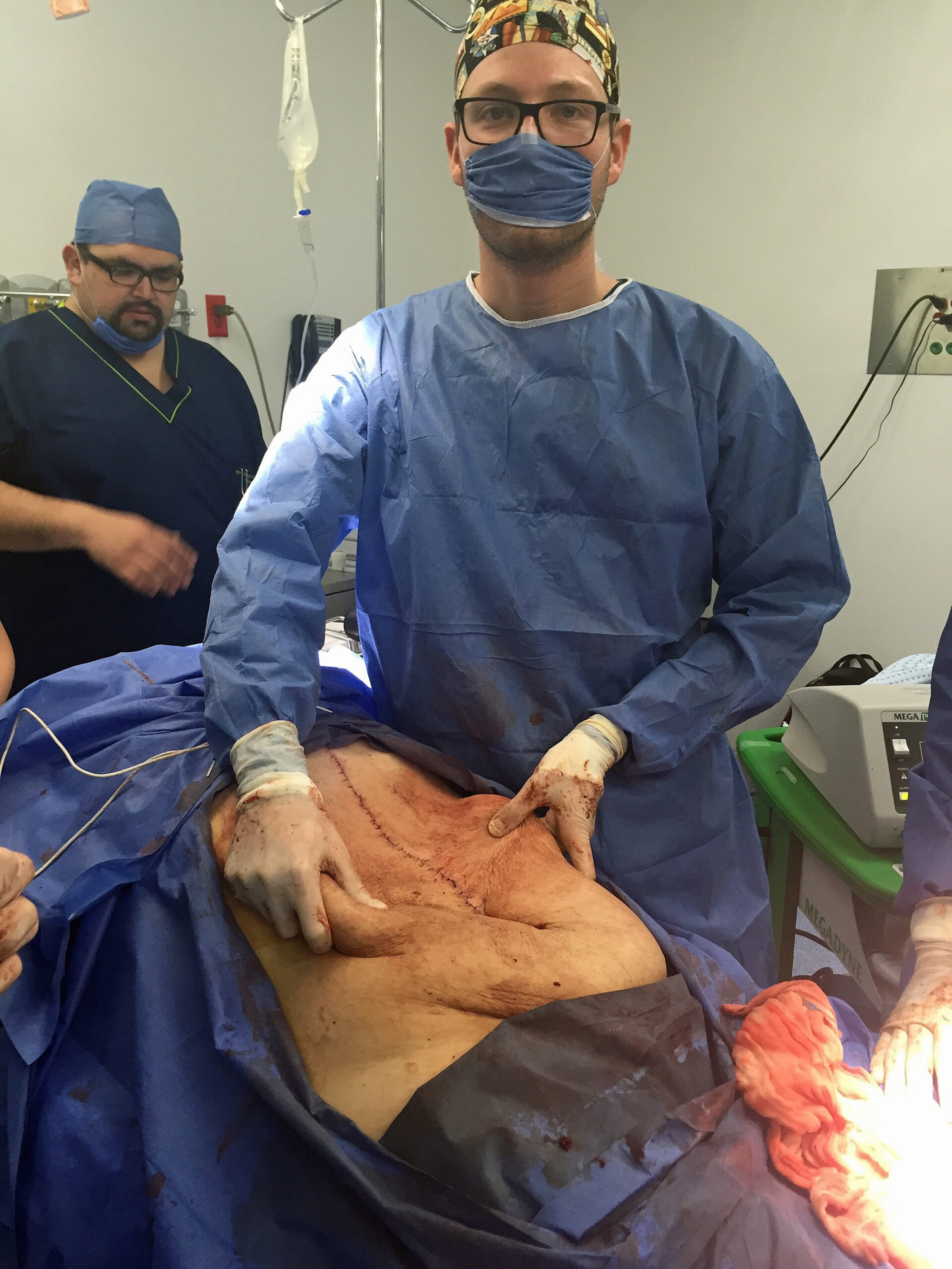 WORLD BIGGEST CYST REMOVED WHOLE