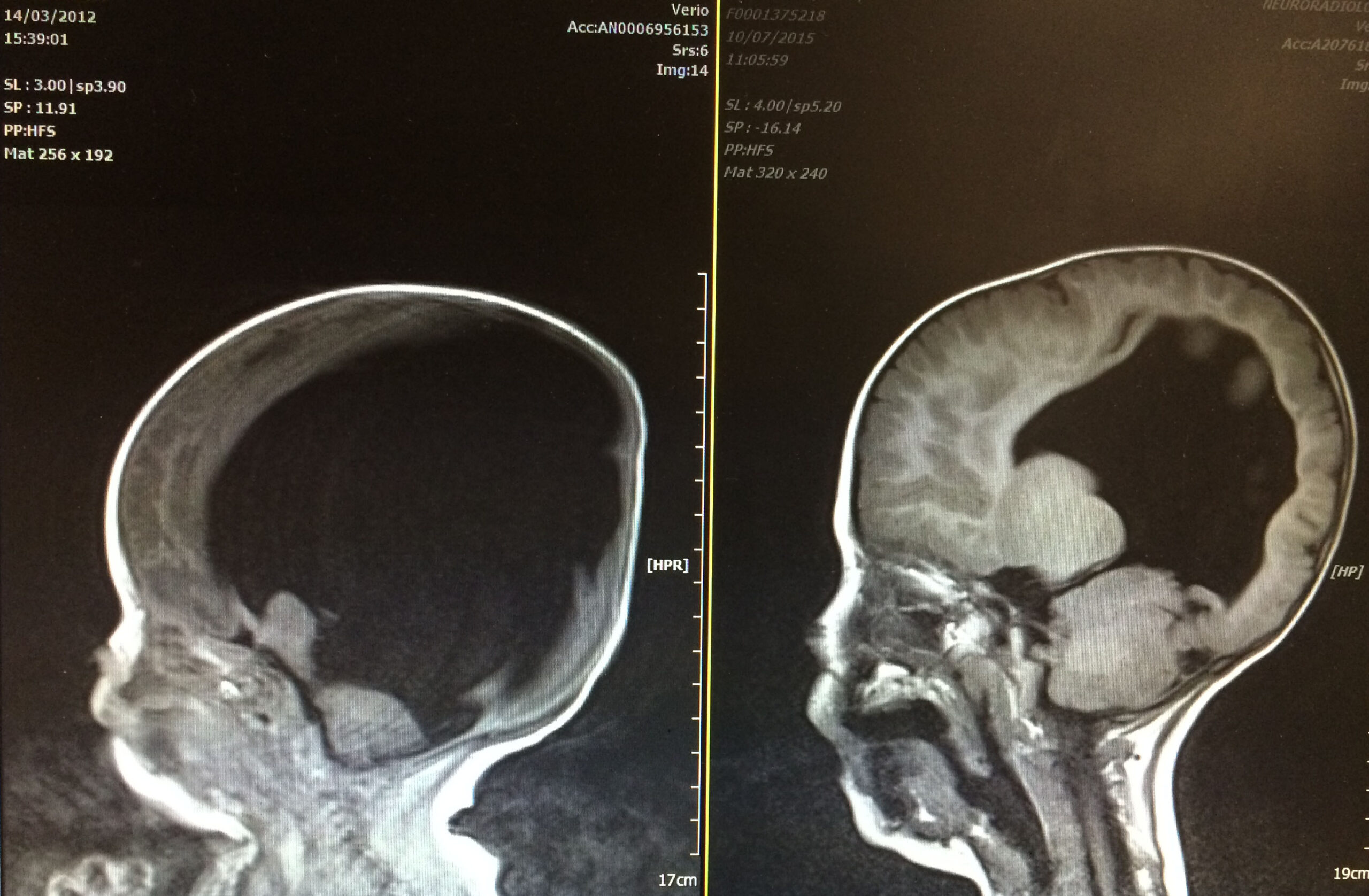 Noah Wall Brain Scan