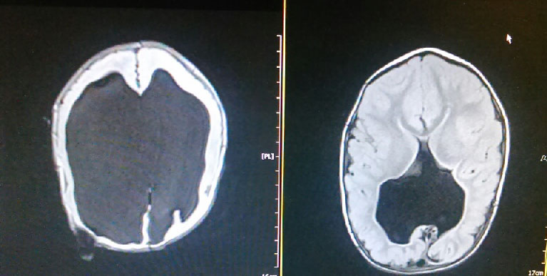 Noah Wall Brain Scan