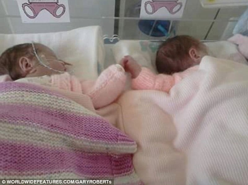 2954098C00000578-3167584-Never_let_me_go_Premature_twins_Grace_left_and_Lily_Johnstone_wh-a-19_1437394875793.jpg