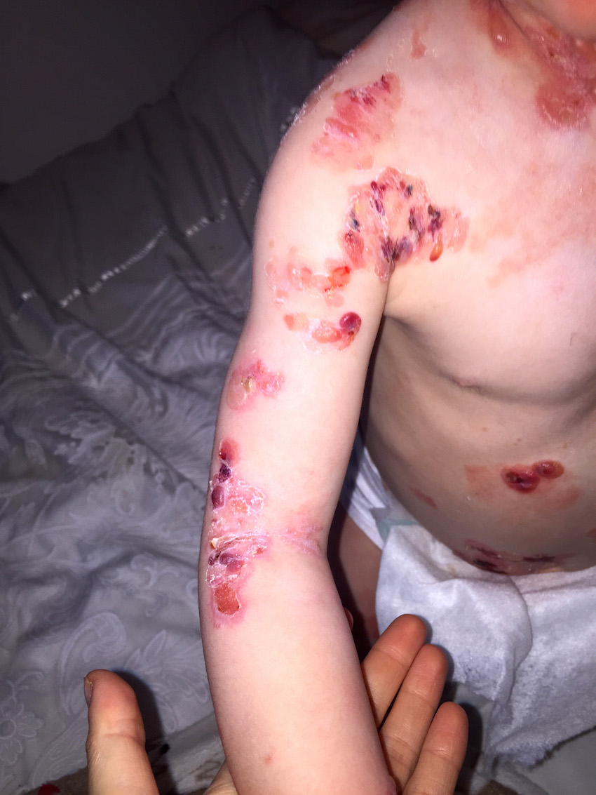 Mum defends daughters condition