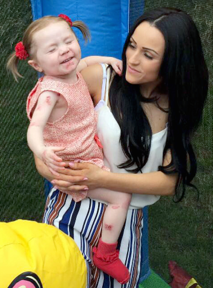 Mum defends daughters condition