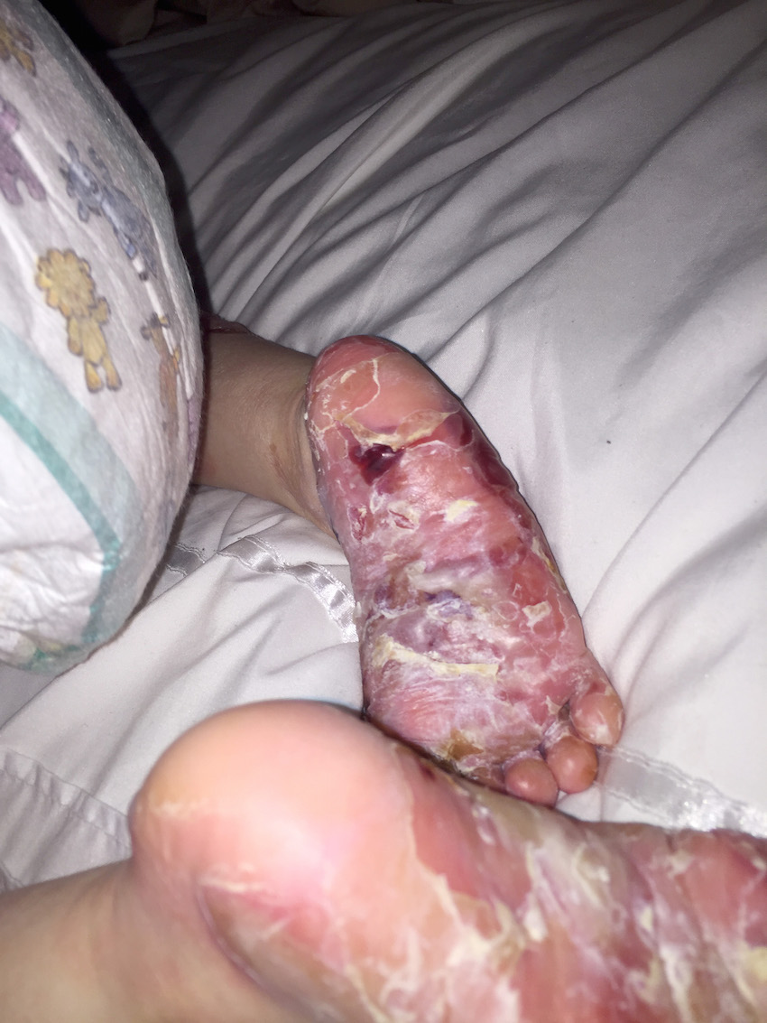 Mum defends daughters condition