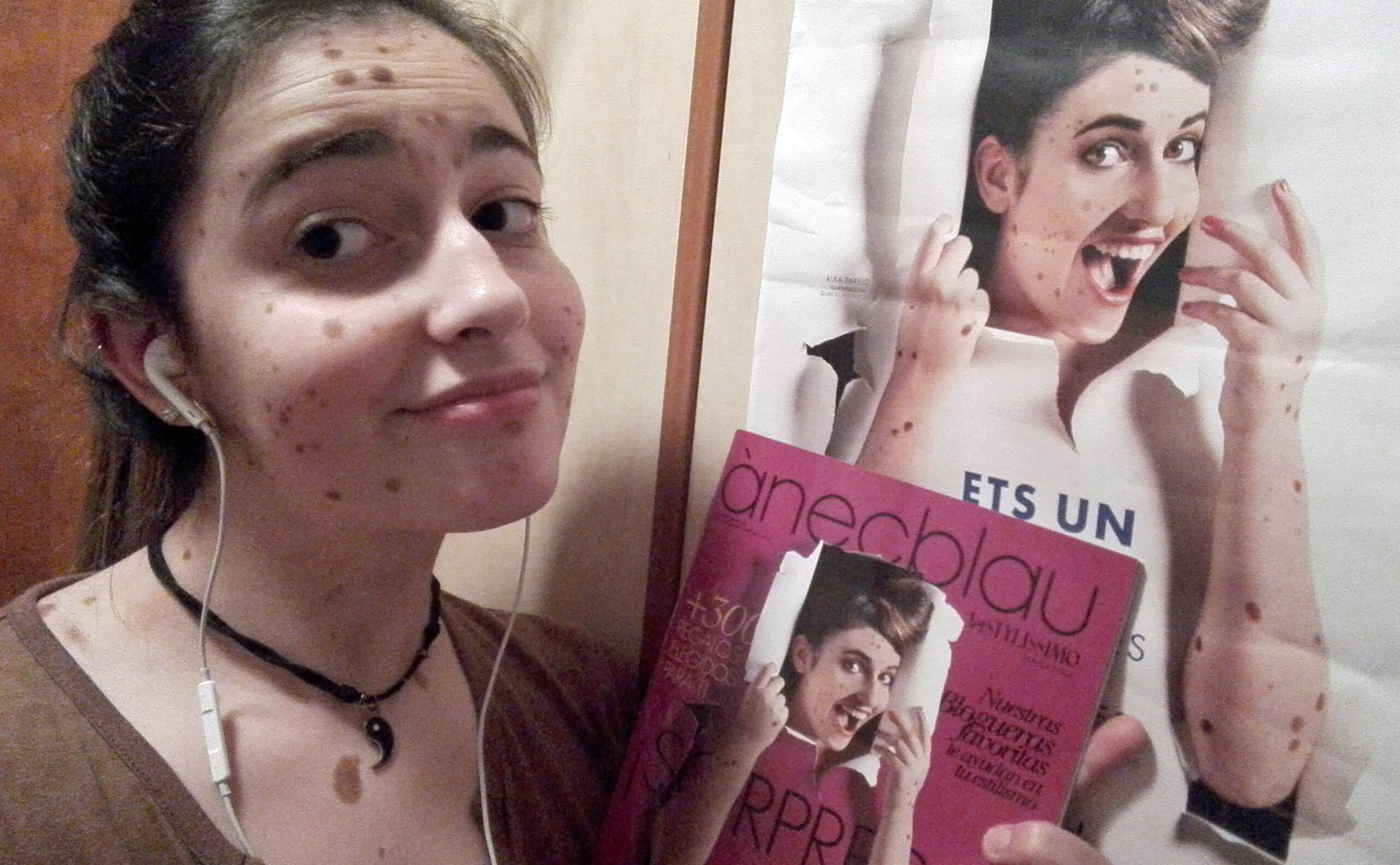 500 BIRTHMARKS GIRL NOW MODEL