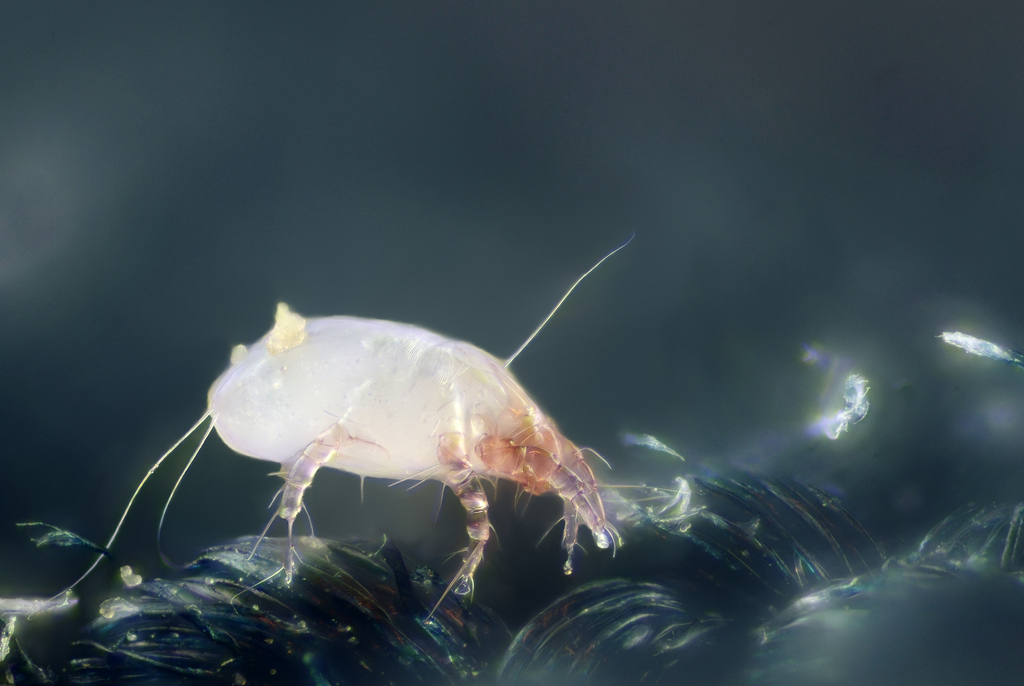 House dust mite - Dermatophagoides pteronyssinus