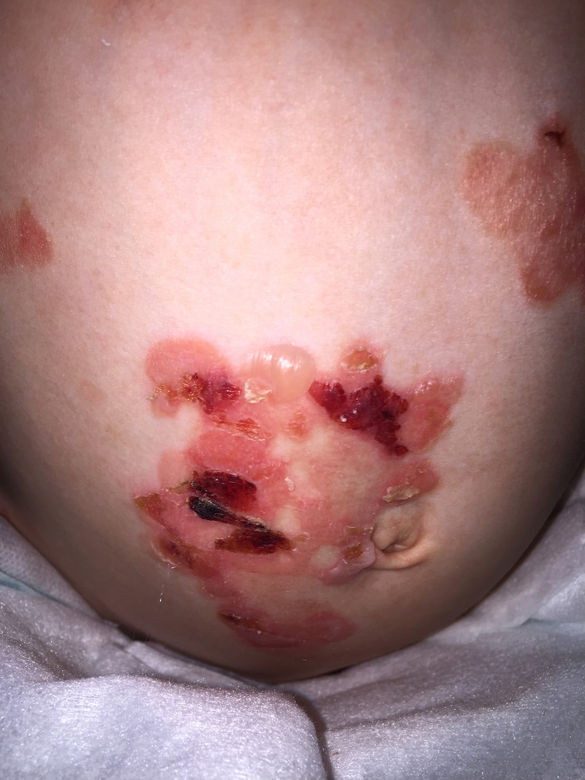 Mum defends daughters condition
