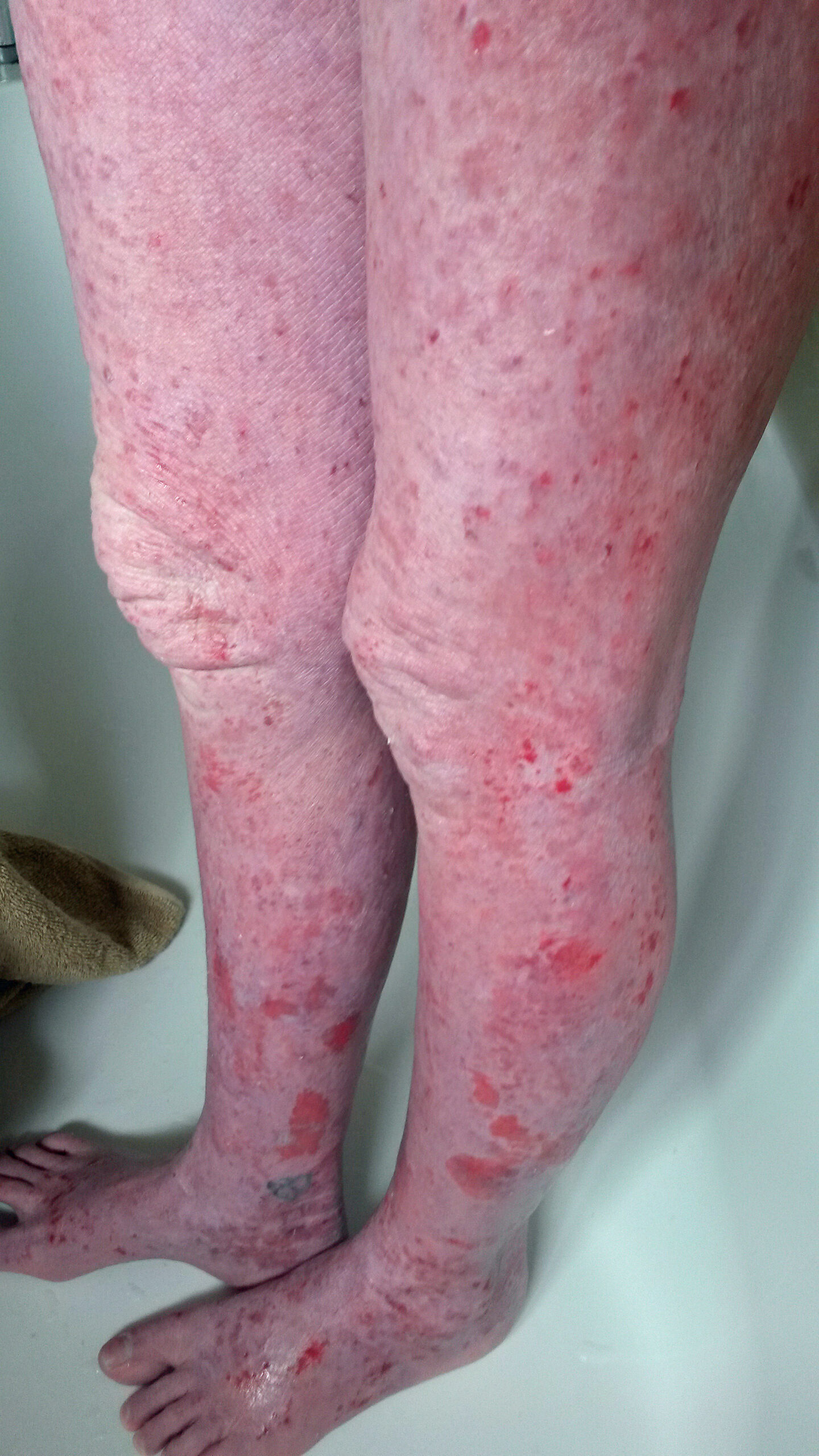 STEROID CREAM MUM MONSTER