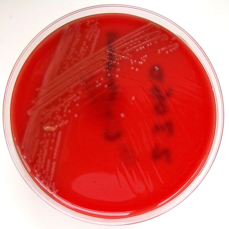 600px-Listeria_monocytogenes_-_Columbia_Horse_Blood_Agar.jpg