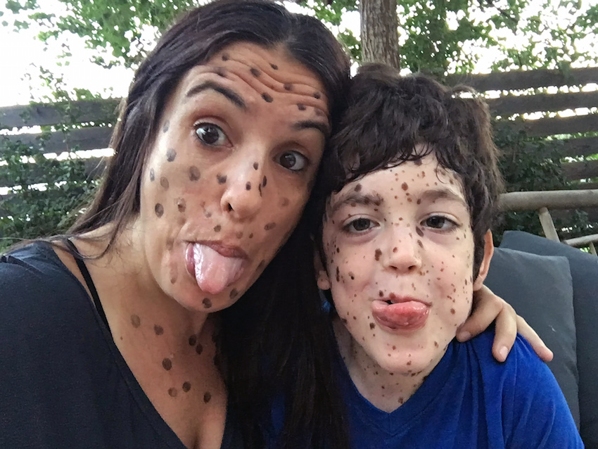 Mum beats bullies with dots Mum beats bullies with dots