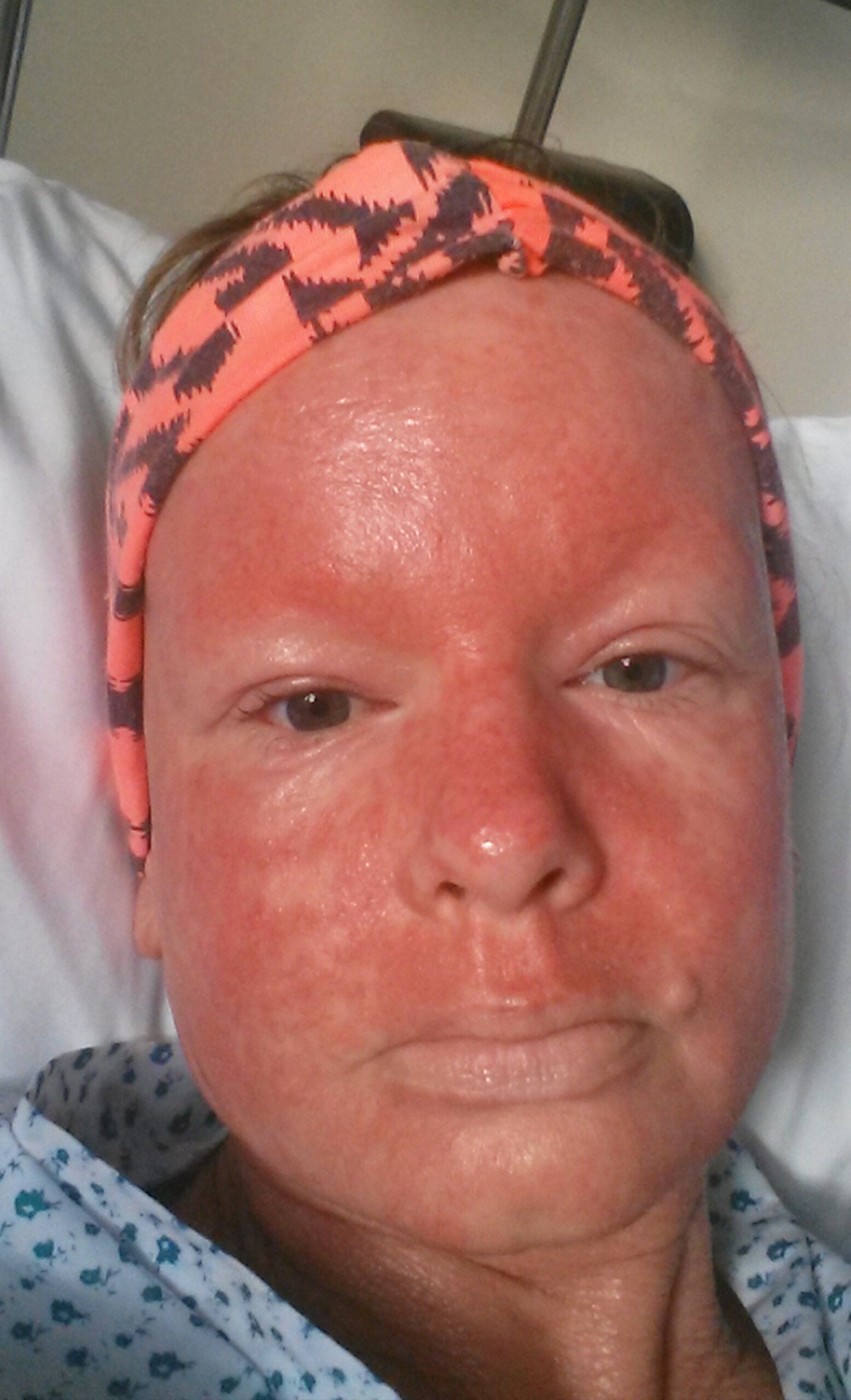 STEROID CREAM MUM MONSTER