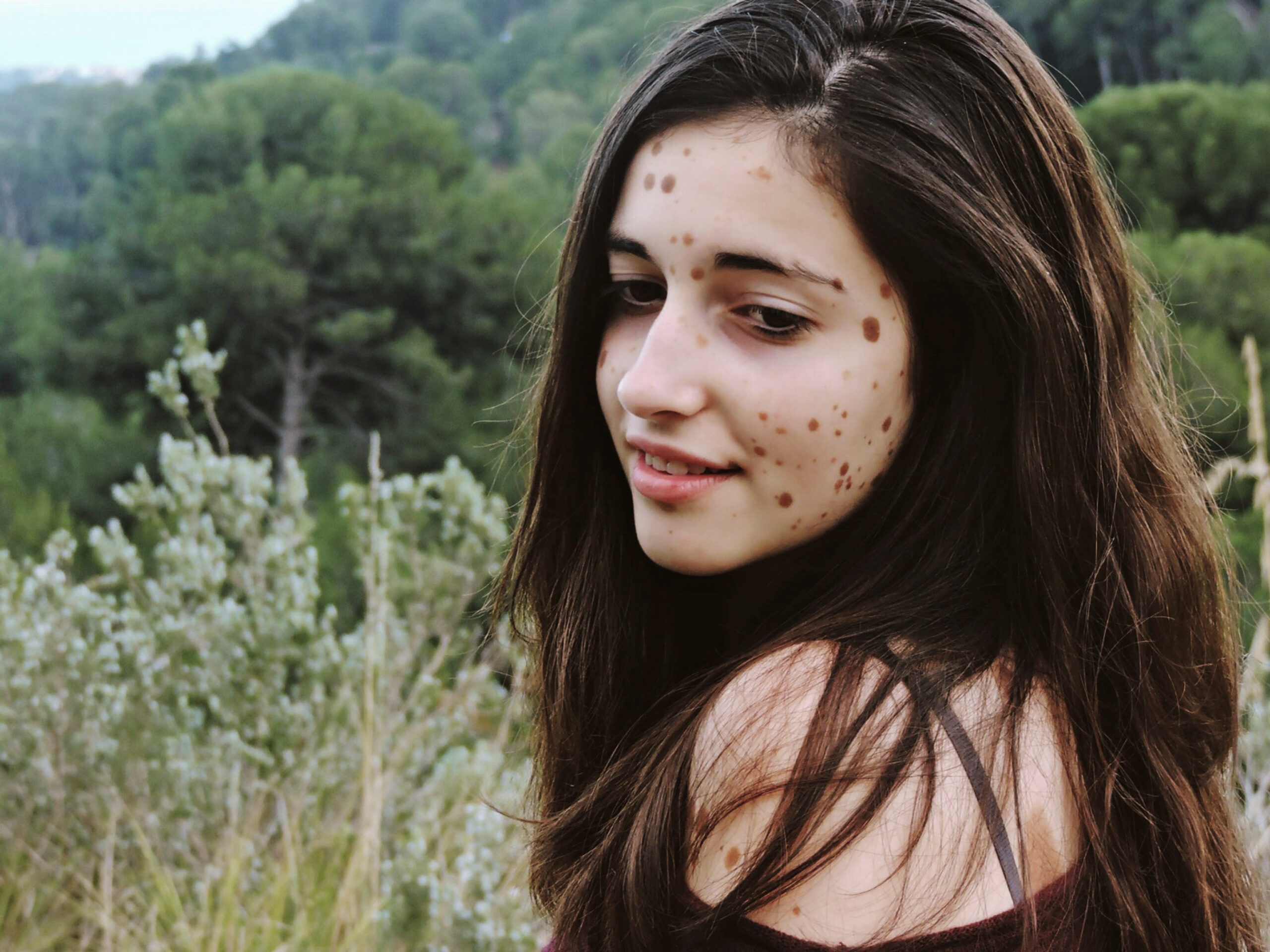 500 BIRTHMARKS GIRL NOW MODEL