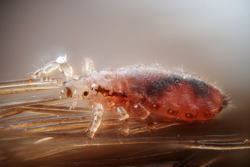 800px-Female_human_head_louse.jpg