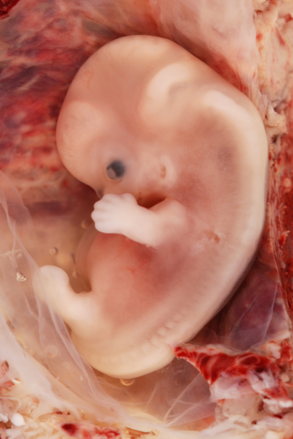 9-Week_Human_Embryo_from_Ectopic_Pregnancy.jpg