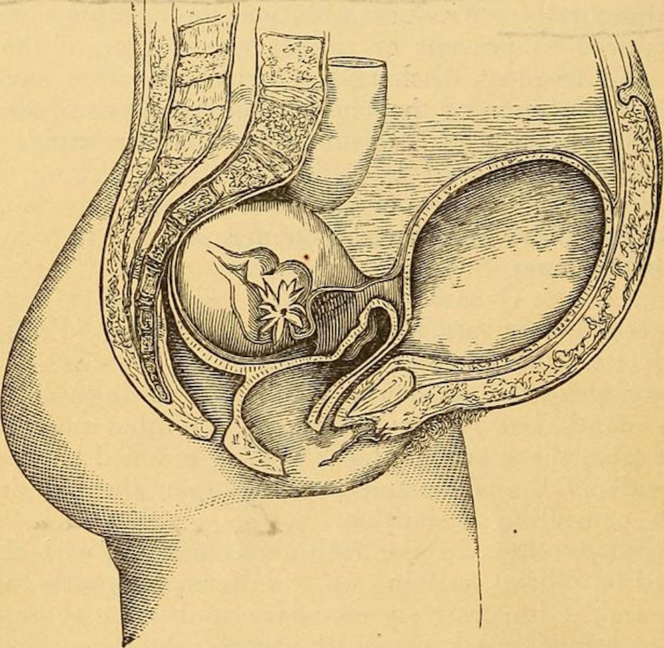 A_manual_of_practical_obstetrics_1895_14596497117.jpg