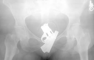 Another-12-Weird-X-Rays-1.jpg