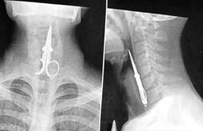 Another-12-Weird-X-Rays-6.jpg