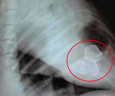Another-12-Weird-X-Rays-7.jpg