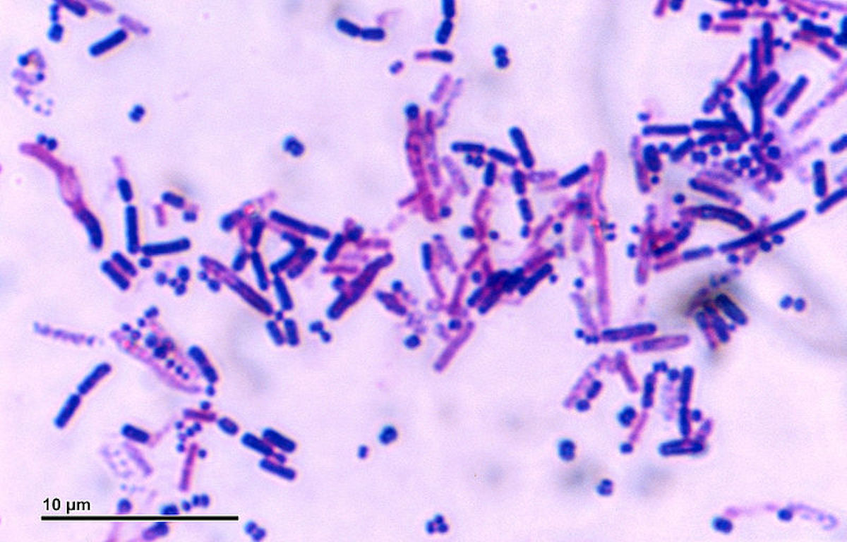 Bacteria_248_28_Airborne_microbes.jpg