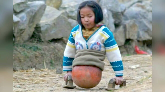 Girl uses a basketball instead of legs