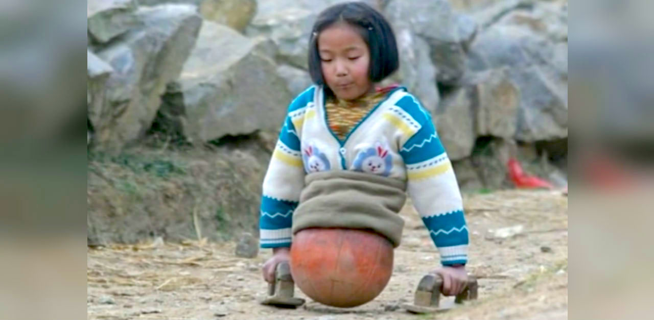 Girl uses a basketball instead of legs