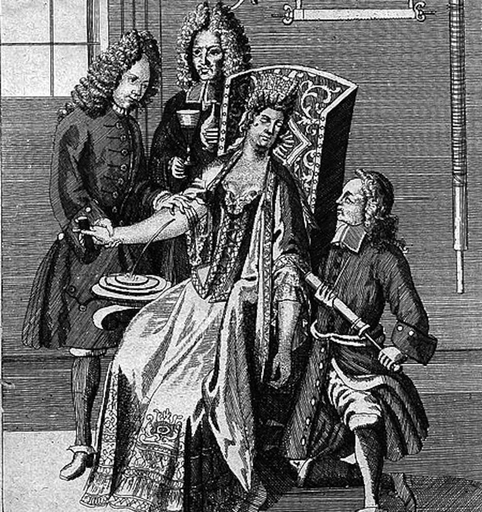Blood_letting_18th_century._Wellcome_L0005142.jpg