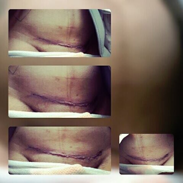 C-Section-1.jpg