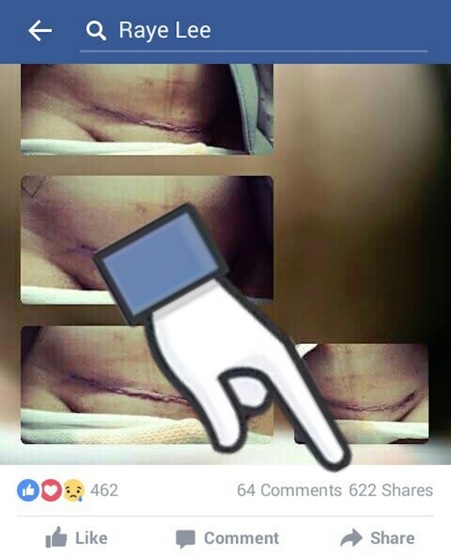 C-Section-6.jpg