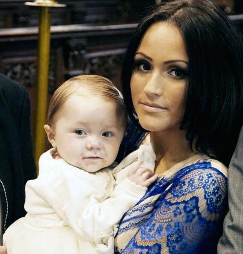 Mum defends daughters condition