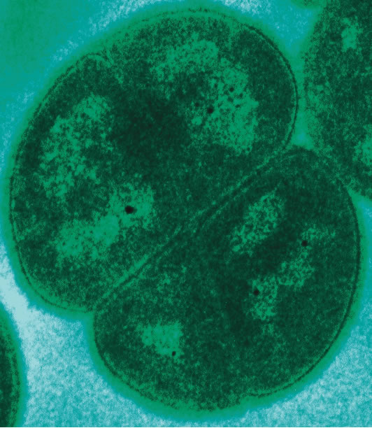 Deinococcus_radiodurans.jpg