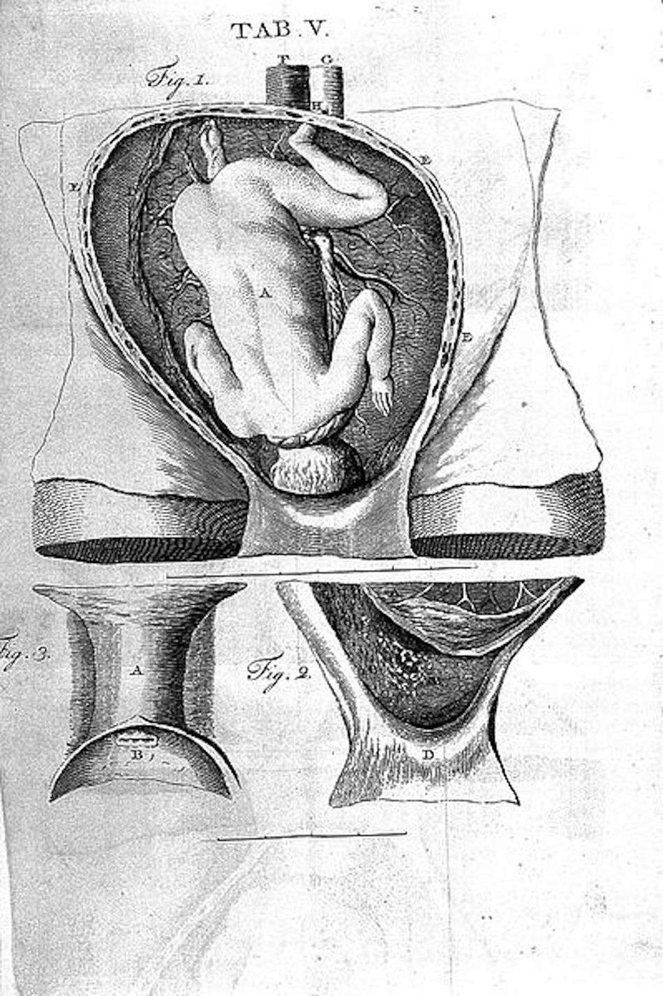 Essays_and_observations_physical_and_literary._Wellcome_L0028178.jpg