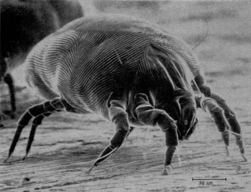 House_Dust_Mite-1.jpg House_Dust_Mite-1.jpg