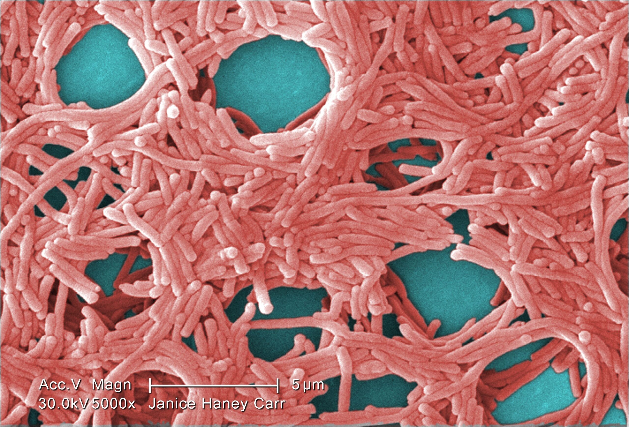 Legionella_pneumophila_SEM_2.jpg
