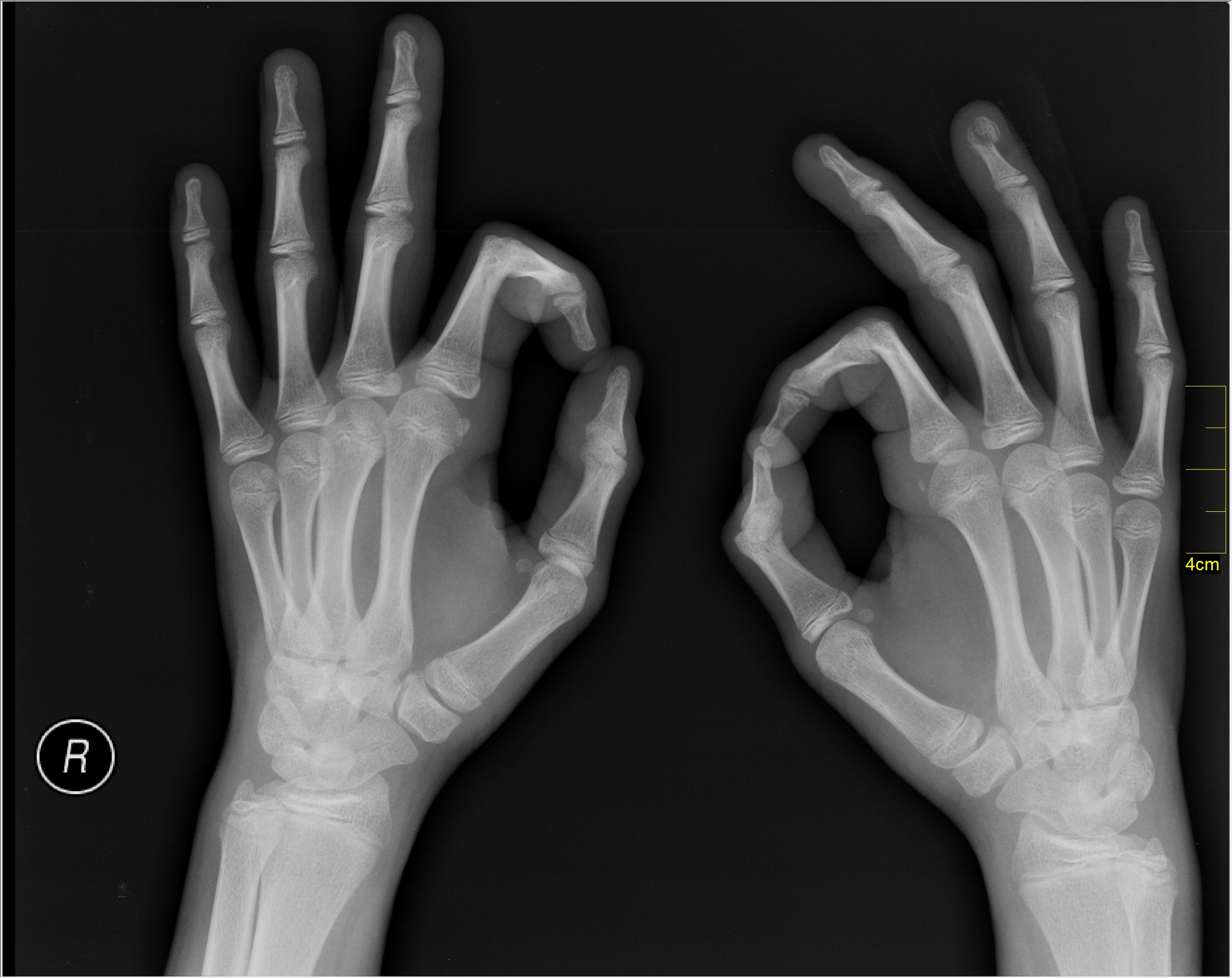 Medical_X-Ray_imaging_RQZ07_nevit.jpg