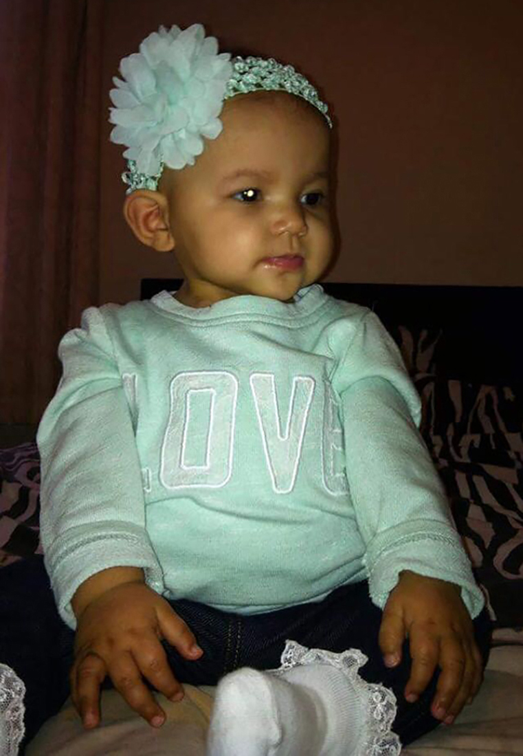 PA Real Life - Jade Bell - retinoblastoma