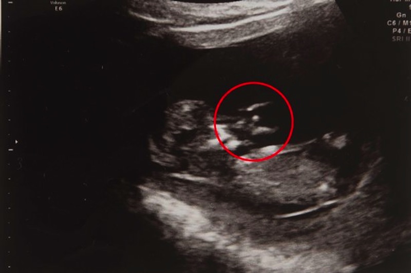 PAY-Joseph-Holman-in-the-baby-scan.jpg