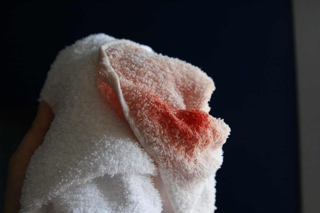 Photo_by_Sharon_Morrow_blood.jpg