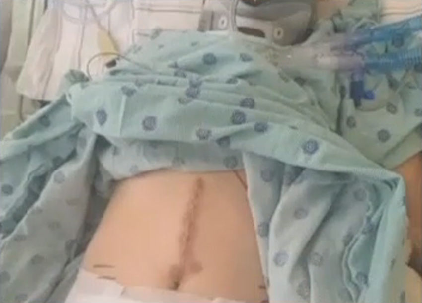 Samantha-Martin-stomach.jpg