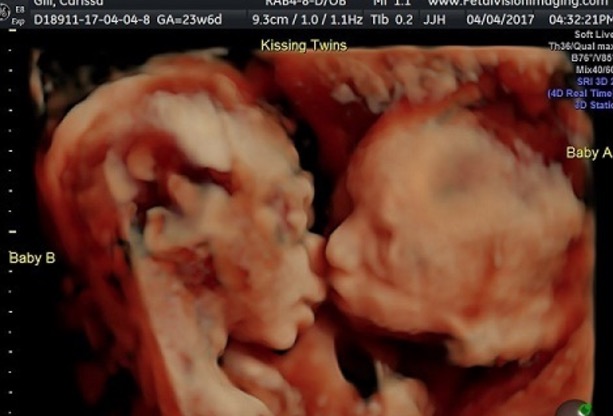 Screen-Shot-2017-04-11-at-9.43.49-AM.jpg