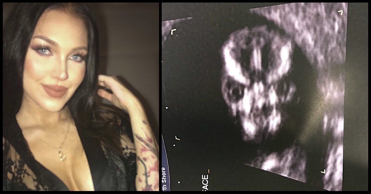 terrifying-sonogram