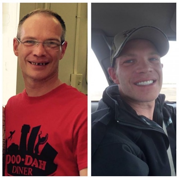 Teeth-beforeafter.jpg