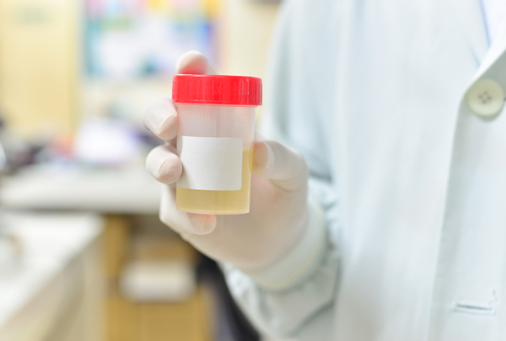 hand with urine container