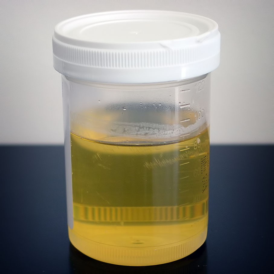 Urine_sample.jpg