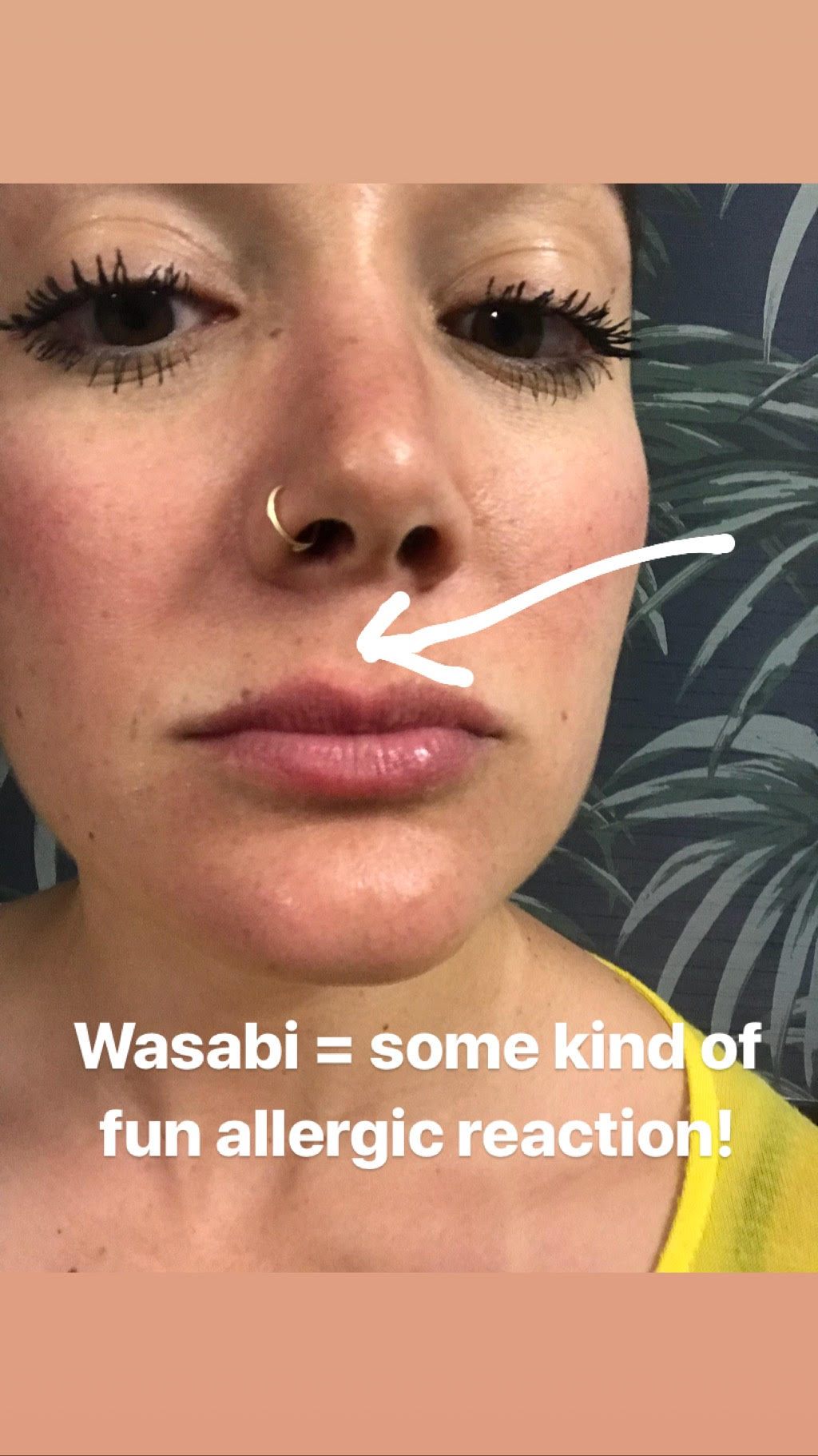 Wasabi-Rash.jpg