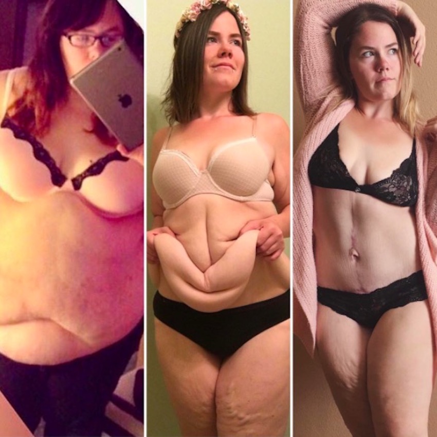 amanda-skin-removal-4.jpg