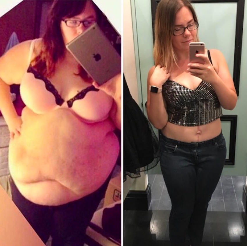 amanda-skin-removal-6.jpg