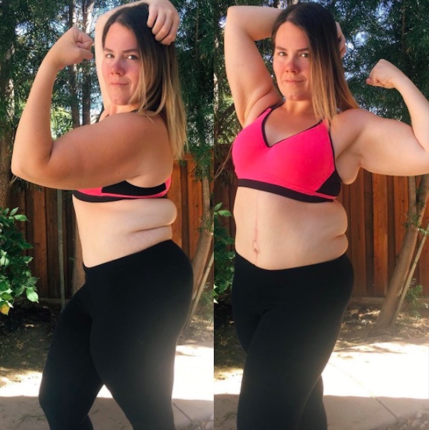 amanda-skin-removal-8.jpg
