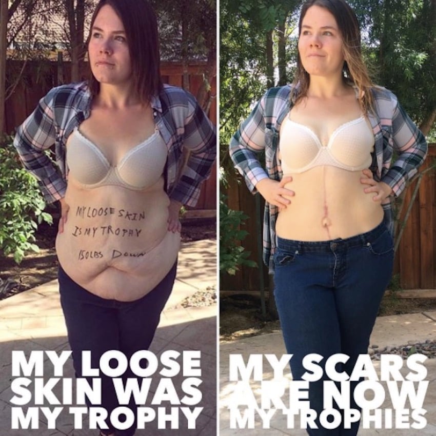 amanda-skin-removal-9.jpg