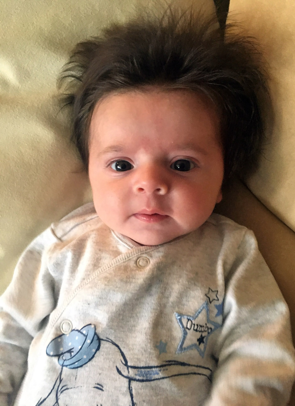 HAIRY SCOTTISH BABY