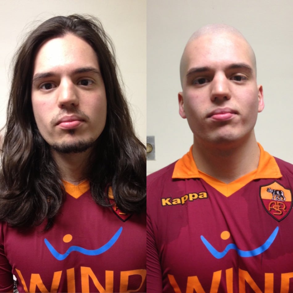 bald-1.jpg